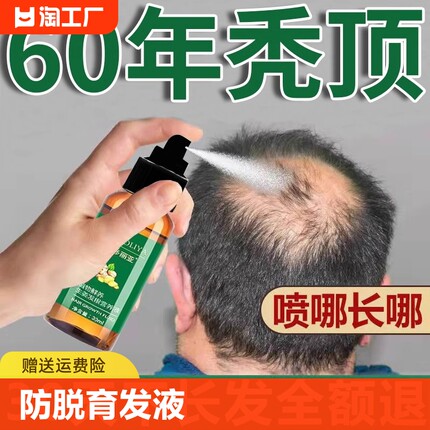 防脱育发液头发生长生发液秃顶增发密发防脱发护理增长液毛囊