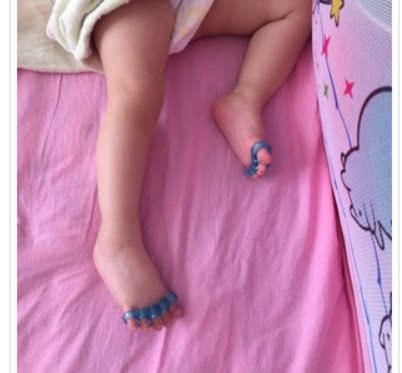 婴儿幼儿童宝宝脚趾矫正器 脚趾重叠弯曲防磨 脚部拇指外翻分趾器