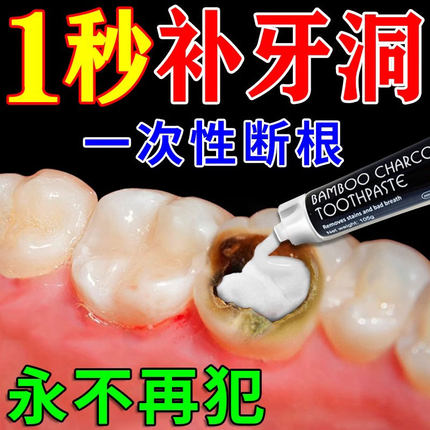 【一秒补牙洞100%痊愈】补牙齿洞膏补牙缝洞堵牙洞神器自己补牙洞