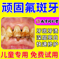 氟斑牙专用牙膏去除牙菌斑祛除牙膏抗敏美白去口臭牙齿美白牙稀SC