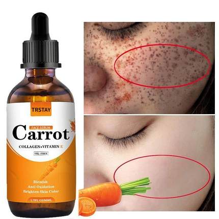 New Carrot Essence Essential oils Dark Spot Corrector Face W