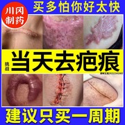 日本进口疤克祛疤膏巴克去疤痕修复除疤膏儿童烫伤官方旗舰店正品