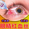 眼药水缓解去除去黄去红血丝抗疲劳眼干红视力模糊发痒灼痛滴眼液
