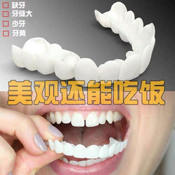 牙套吃饭神器老人假牙套仿真通用缺牙临时牙套遮盖门牙齿矫正美白